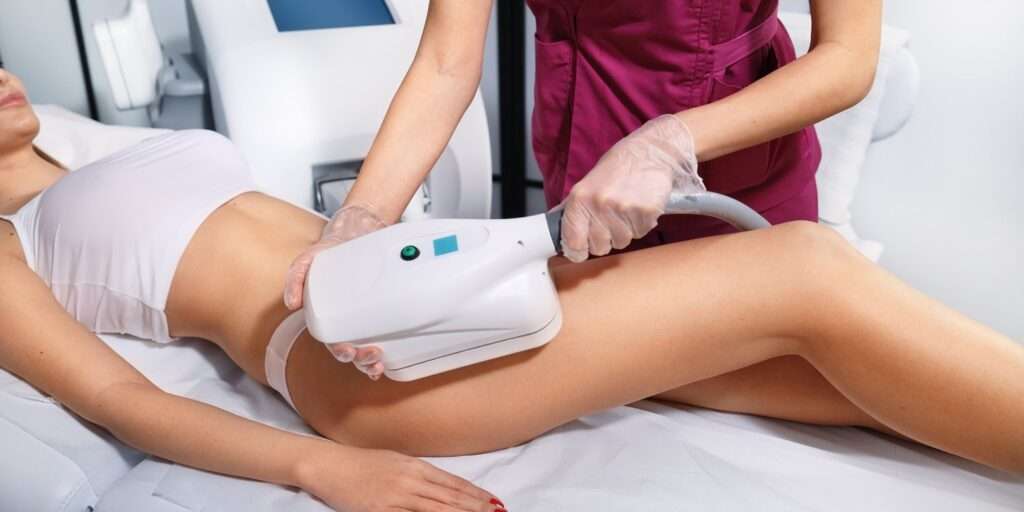 FatfreezingorCryolipolysistreatment