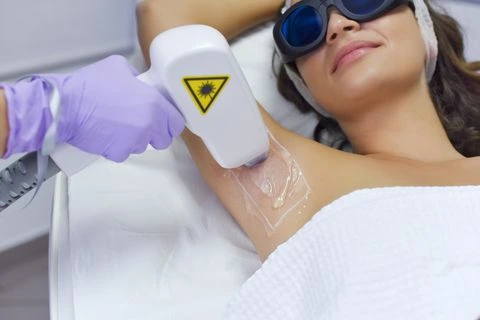 epilare definitiva laser1