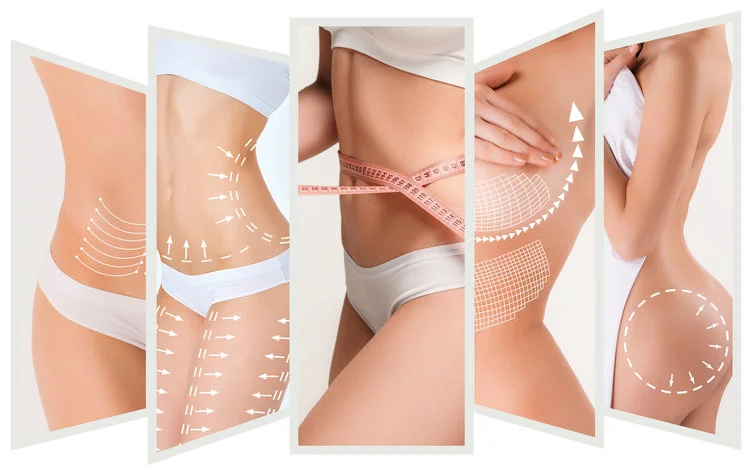 lipoliza laser